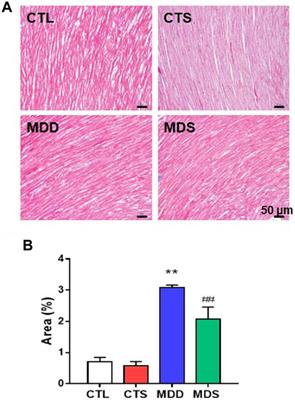 Corrigendum: The Reversal Effect of Sigma-1 Receptor (S1R) Agonist, SA4503, on Atrial Fibrillation After Depression and Its Underlying Mechanism